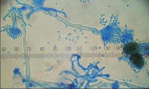 (B) Konidiophore (a) und Kleistothezien (b) von Eurotium sp.  &copy; www.myko-lab.de